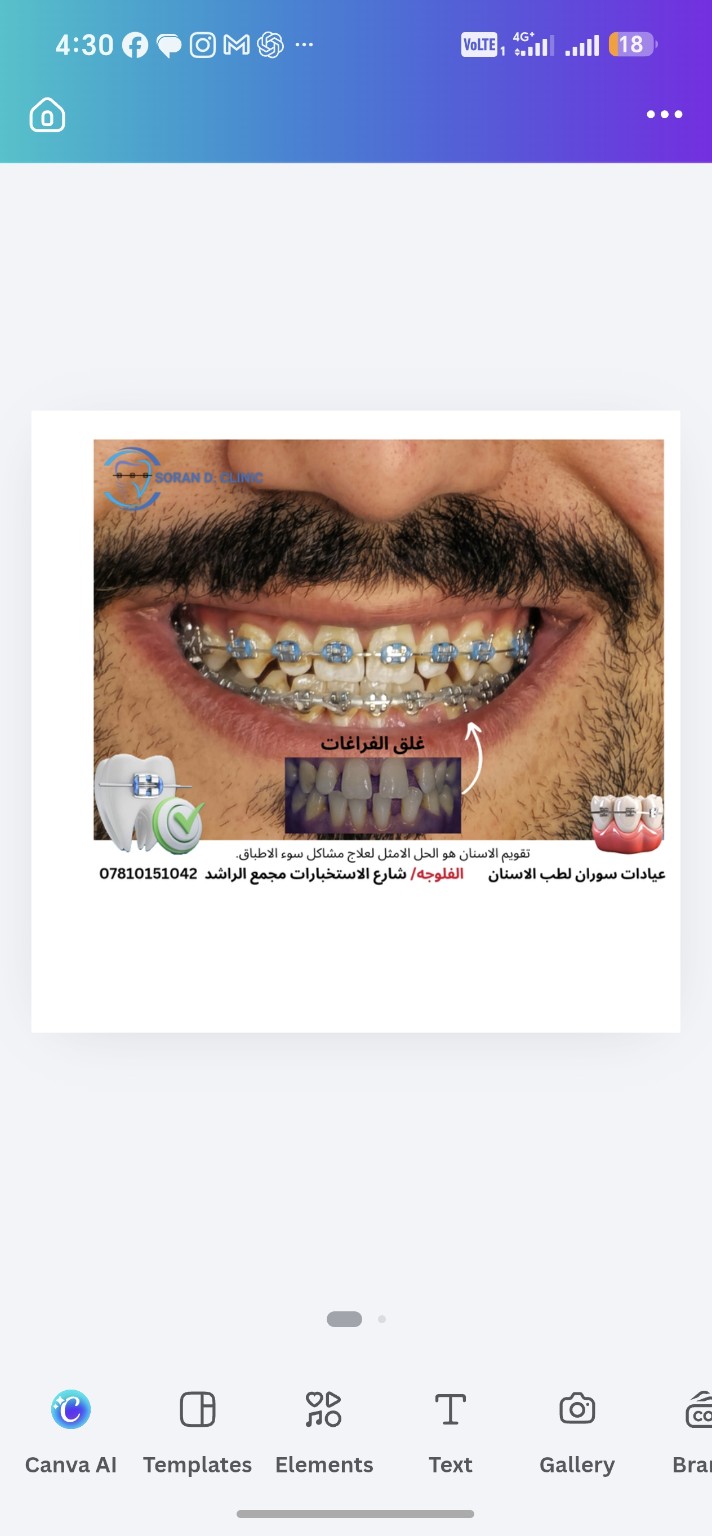 متابعة إغلاق الفراغات — خلال العلاج
